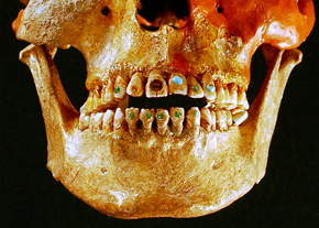 jeweled-teeth-picture_290.jpg